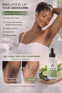 Lighten Up! Dark Spot Corrector